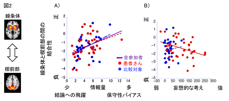 妄想の形成に関わる認知神経メカニズムを解明 ~妄想の新しい治療法の開発に期待~