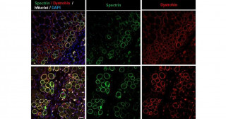 Creating a rat model for testing cell therapy in Duchenne muscular dystrophy