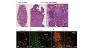 Improving the Safety of iPS Cell-Derived Pancreatic Islets by Eliminating Unwanted Cells