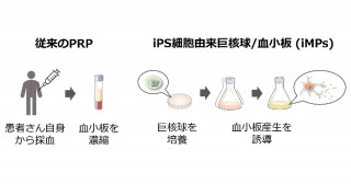 iPS細胞由来巨核球と血小板が創傷治癒を促進～既存治療の欠点を解消する新規製剤の開発に期待～